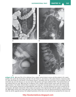 Basic radiology, 2nd ed.