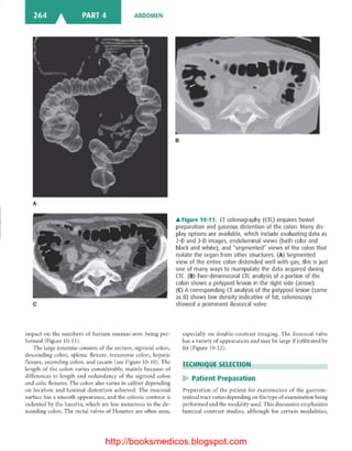 Basic radiology, 2nd ed.