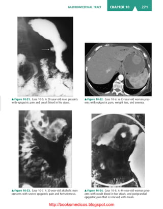 Basic radiology, 2nd ed.