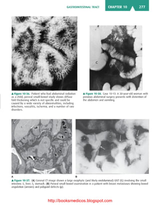 Basic radiology, 2nd ed.