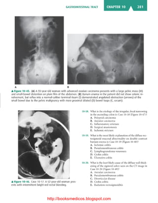 Basic radiology, 2nd ed.