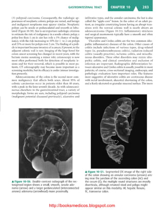 Basic radiology, 2nd ed.