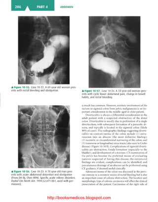 Basic radiology, 2nd ed.