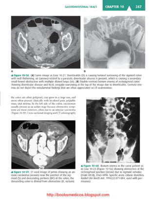 Basic radiology, 2nd ed.