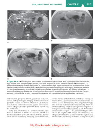 Basic radiology, 2nd ed.