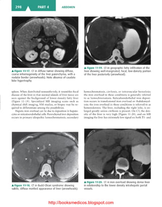 Basic radiology, 2nd ed.