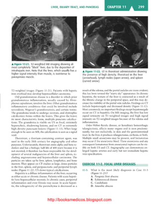 Basic radiology, 2nd ed.