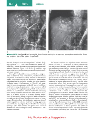 Basic radiology, 2nd ed.