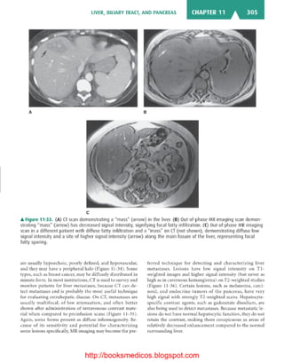 Basic radiology, 2nd ed.