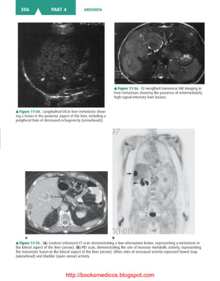 Basic radiology, 2nd ed.