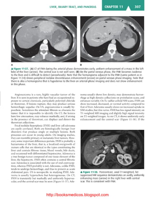 Basic radiology, 2nd ed.