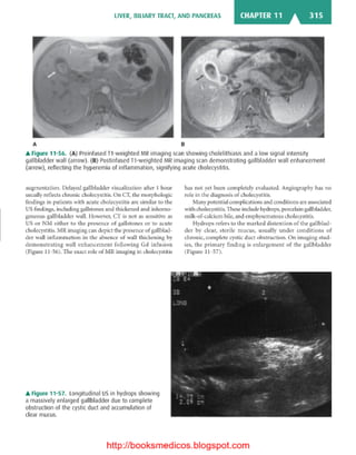Basic radiology, 2nd ed.