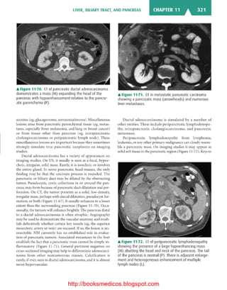 Basic radiology, 2nd ed.