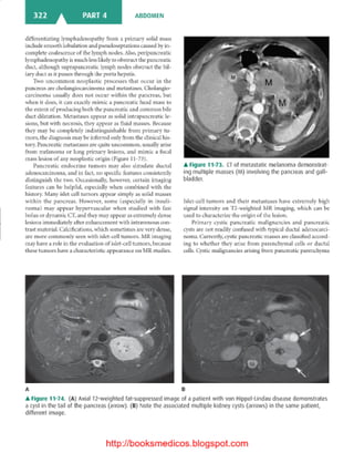 Basic radiology, 2nd ed.