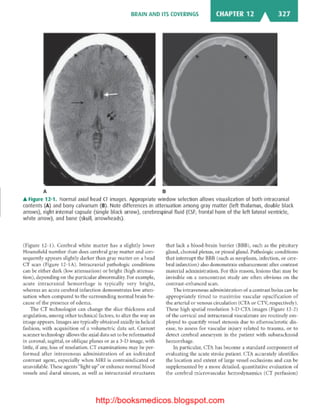 Basic radiology, 2nd ed.