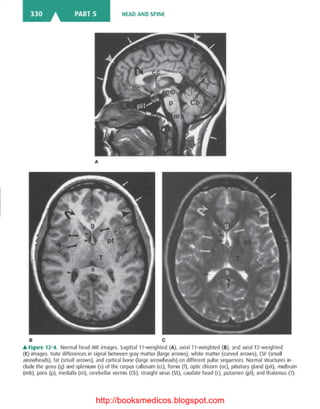 Basic radiology, 2nd ed.
