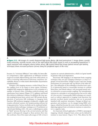 Basic radiology, 2nd ed.