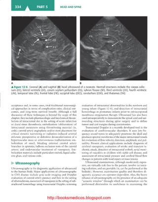 Basic radiology, 2nd ed.