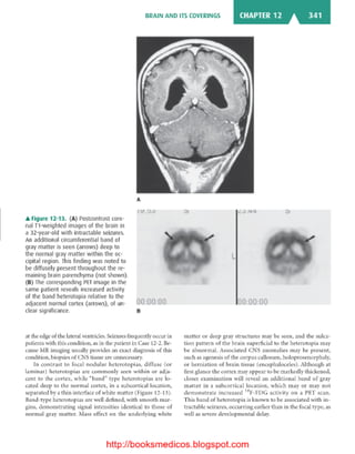 Basic radiology, 2nd ed.