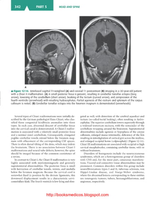 Basic radiology, 2nd ed.