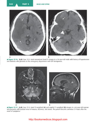 Basic radiology, 2nd ed.