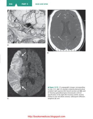 Basic radiology, 2nd ed.