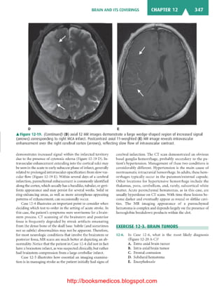 Basic radiology, 2nd ed.