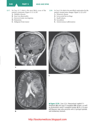 Basic radiology, 2nd ed.