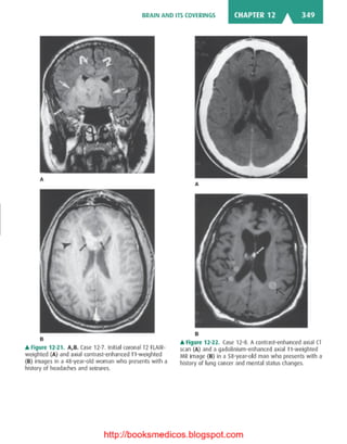 Basic radiology, 2nd ed.