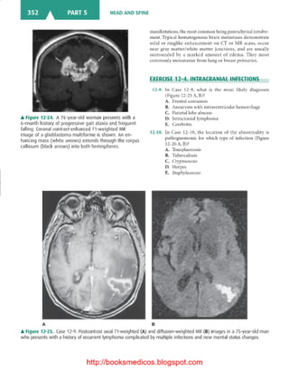 Basic radiology, 2nd ed.
