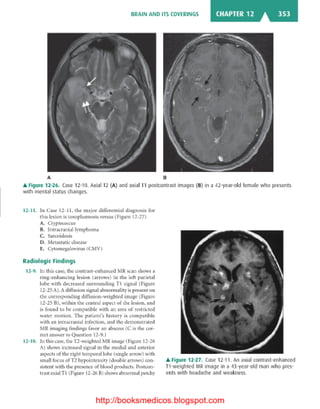 Basic radiology, 2nd ed.