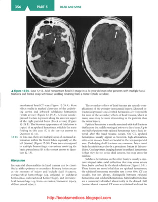 Basic radiology, 2nd ed.