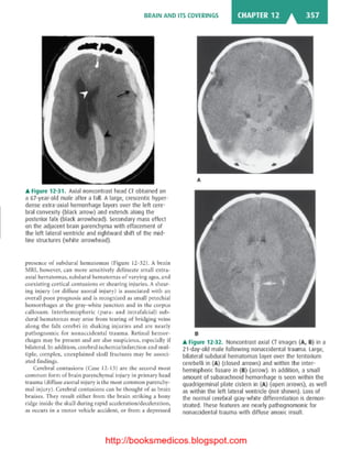 Basic radiology, 2nd ed.