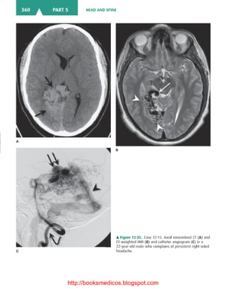 Basic radiology, 2nd ed.