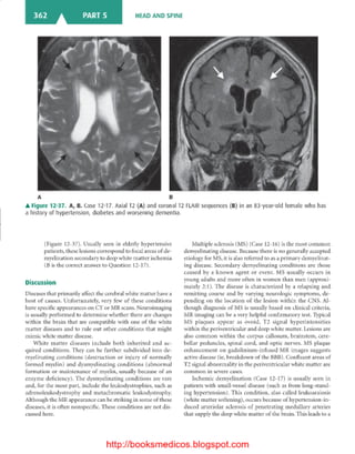 Basic radiology, 2nd ed.