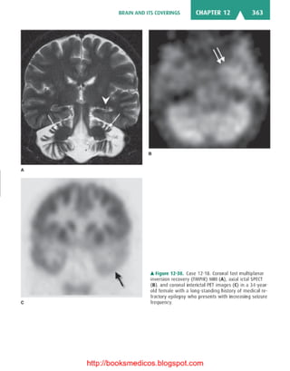 Basic radiology, 2nd ed.