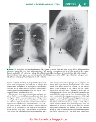 Basic radiology, 2nd ed.