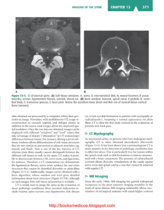 Basic radiology, 2nd ed.