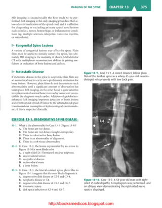 Basic radiology, 2nd ed.