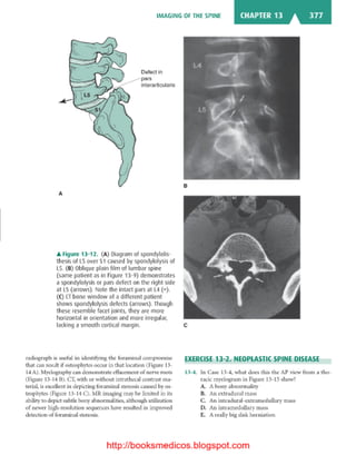 Basic radiology, 2nd ed.