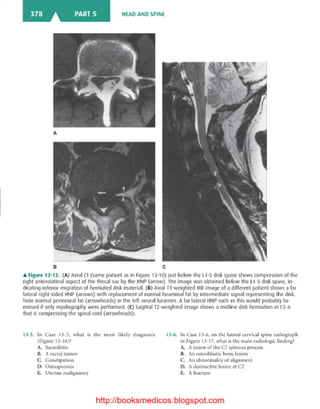 Basic radiology, 2nd ed.