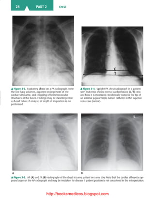 Basic radiology, 2nd ed.