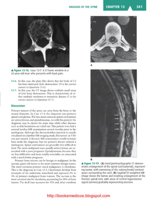 Basic radiology, 2nd ed.