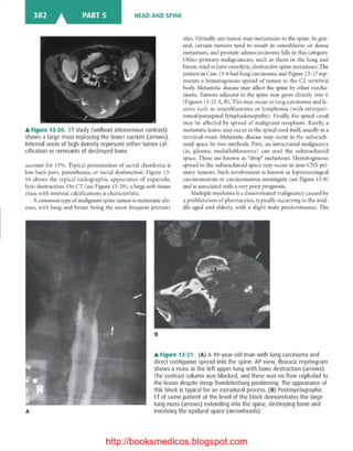 Basic radiology, 2nd ed.