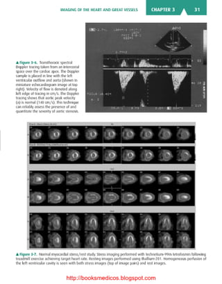 Basic radiology, 2nd ed.