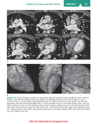 Basic radiology, 2nd ed.