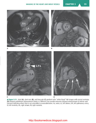 Basic radiology, 2nd ed.