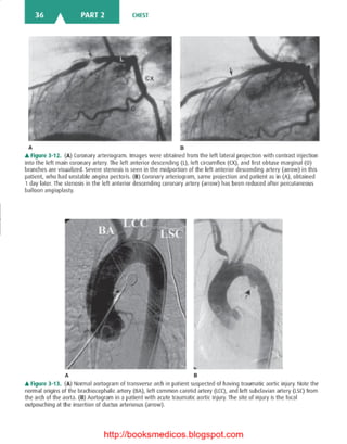 Basic radiology, 2nd ed.