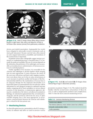 Basic radiology, 2nd ed.