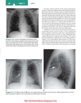 Basic radiology, 2nd ed.